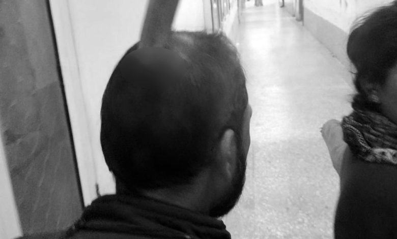 ਆਗਰਾ 'ਚ ਨੌਜਵਾਨ ਦੇ ਸਿਰ ਵਿੱਚ ਬਰਫ਼ ਦੇ ਸੂਏ ਨਾਲ ਵਾਰ 1 588468572 1378981007515663 6849786826750184940 n