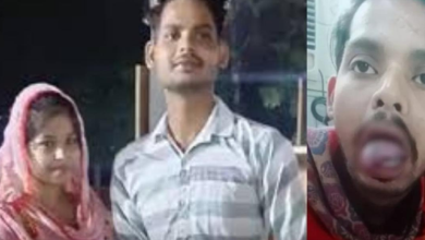 ਨਵ-ਵਿਆਹੁਤਾ ਨੇ ਆਪਣੇ ਪਤੀ ਦੀ ਵੱਢ ਦਿੱਤੀ ਜੀਭ , ਸ਼ਰਾਬ ਪੀਣ ਅਤੇ ਇੰਸਟਾਗ੍ਰਾਮ 'ਤੇ ਰੀਲਾਂ ਬਣਾਉਣ ਤੋਂ ਰੋਕਦਾ ਸੀ ਪਤੀ 3 Photo of ਨਵ-ਵਿਆਹੁਤਾ ਨੇ ਆਪਣੇ ਪਤੀ ਦੀ ਵੱਢ ਦਿੱਤੀ ਜੀਭ , ਸ਼ਰਾਬ ਪੀਣ ਅਤੇ ਇੰਸਟਾਗ੍ਰਾਮ ‘ਤੇ ਰੀਲਾਂ ਬਣਾਉਣ ਤੋਂ ਰੋਕਦਾ ਸੀ ਪਤੀ